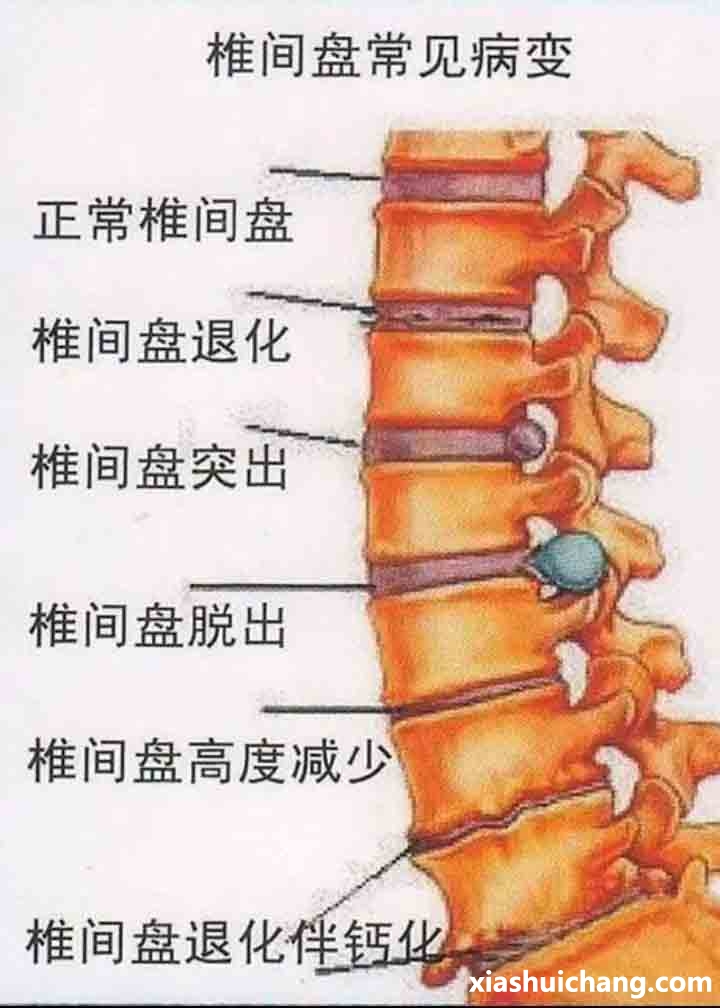 002859egii4cuccyniqxgx.jpg